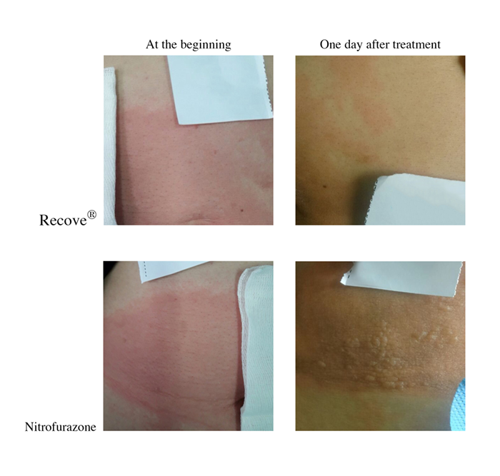 recove-impact-image